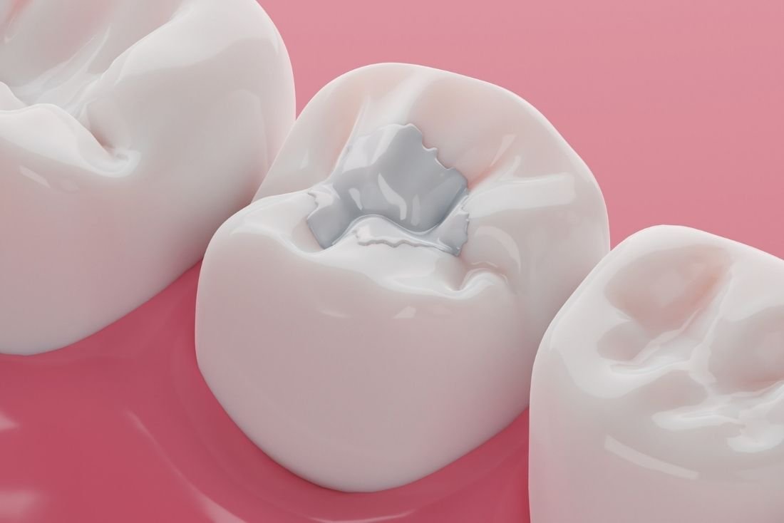 Rome Dentist